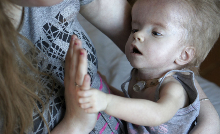 В 2 года Катя весит как полугодовалый малыш. Помогите накормить девочку!