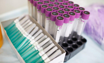 Генетические анализы маленьких пермяков начнёт оплачивать администрация Перми