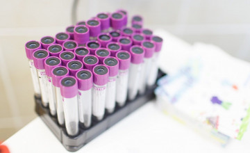 Екатерина думала, что это реклама, а оказалось — шанс спасти жизнь