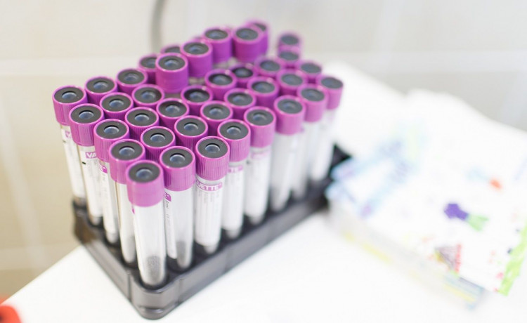 Екатерина думала, что это реклама, а оказалось — шанс спасти жизнь